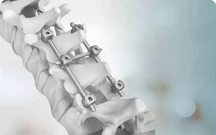Prestanda och användning av titanlegeringsmaterial som medicinska titanlegeringar.